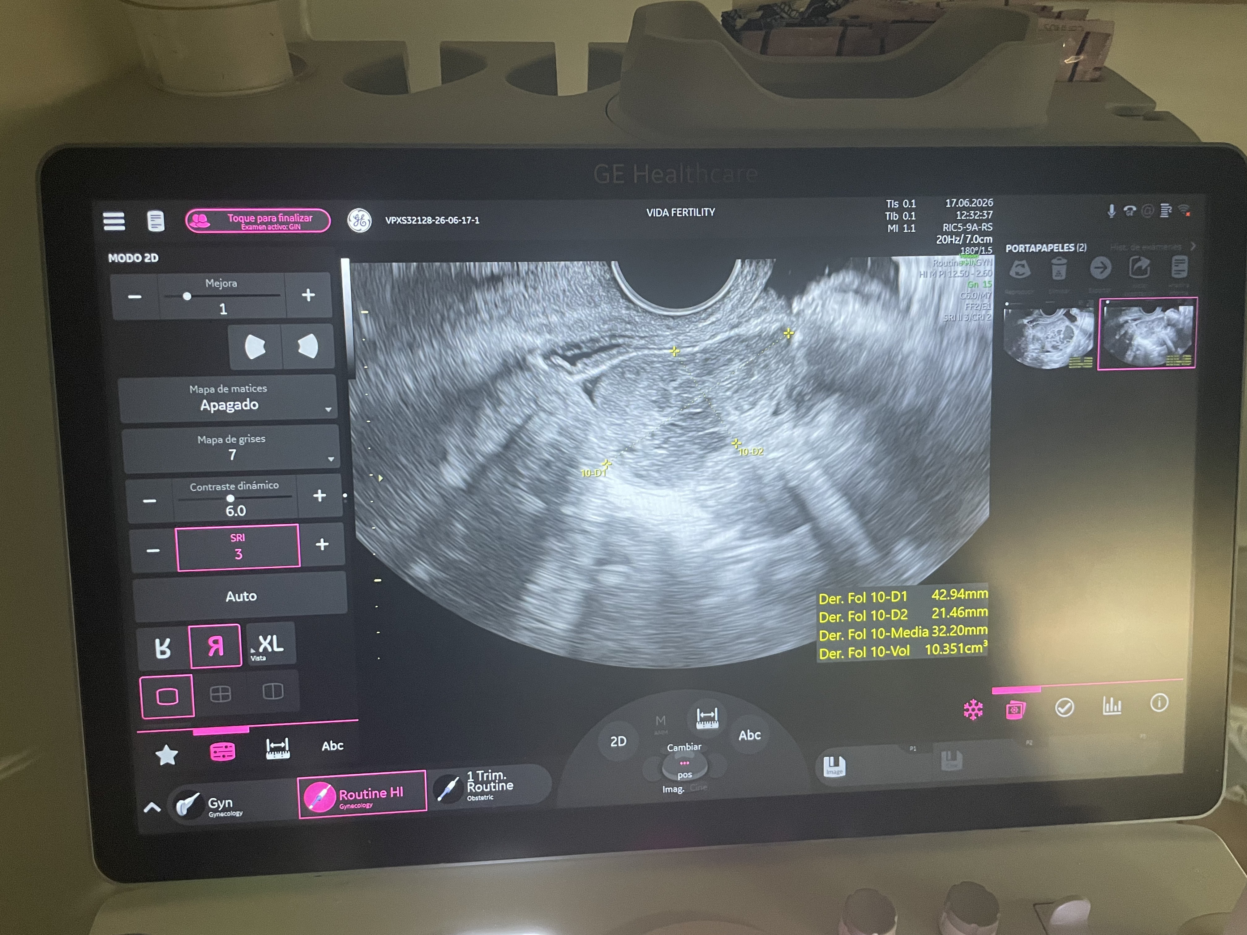 A Conversation with my Ovaries